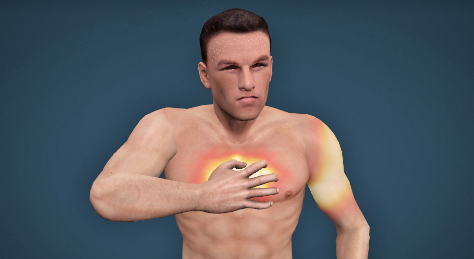 Heart attack 3D scene Mozaik Digital Education and Learning