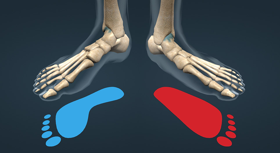 Flat feet 3D scene Mozaik Digital Learning
