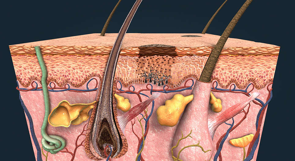 Abbronzatura e cancro alla pelle
