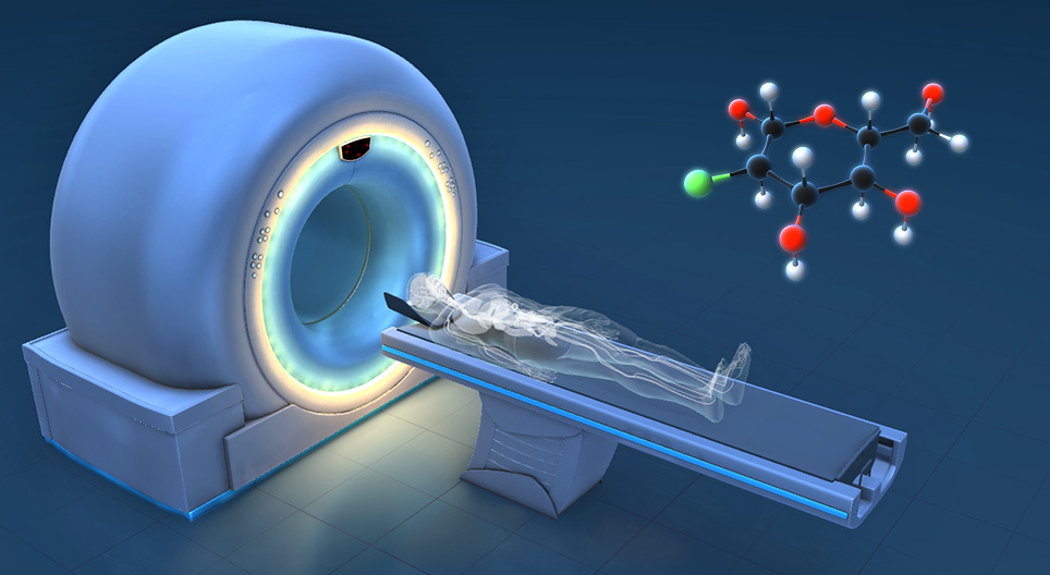 How Does It Work PET CT 3D Vaizdas Mozaik Skaitmeninis 