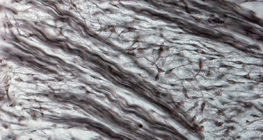 Cartilagine fibrosa (dal naso di un embrione di maiale)