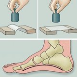 Исследование сводов стопы
