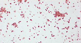 Agente eziologico della gonorrea (Neisseria gonorrhoeae)