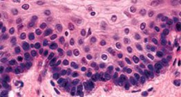 Epitelio escamoso estratificado no queratinizado