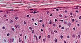 Epitelio escamoso estratificado queratinizado