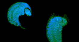 La larva degli Icneumonidi che si sviluppa nella pupa di drosofila come una parassita