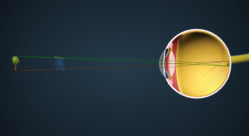 Tworzenie się obrazu w oku model 3D Mozaik edukacja i nauka cyfrowa