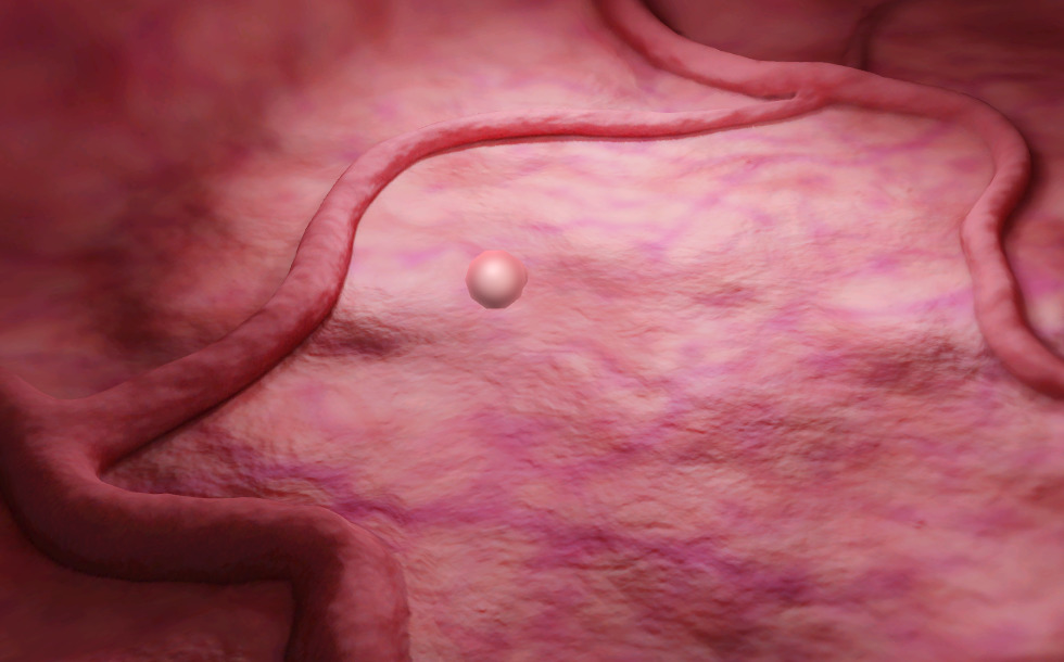 Cancer pulmonar