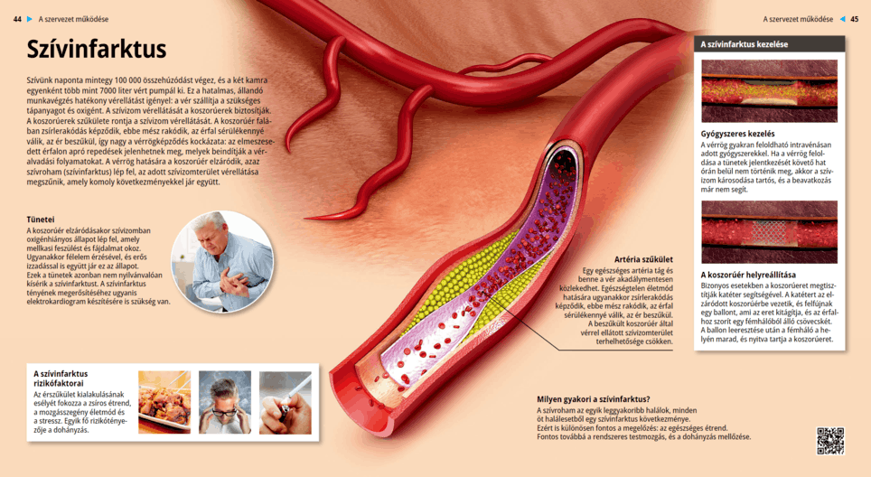 Инфаркт миокарда - Цифровой урок - Цифровое образование и обучение Мozaik
